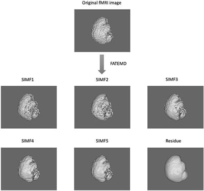 Spatiotemporal Empirical Mode Decomposition of Resting-State fMRI Signals: Application to Global Signal Regression